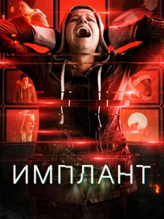 Имплант