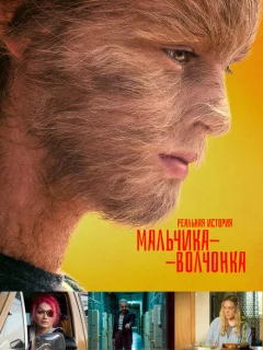 Реальная история мальчика-волчонка	